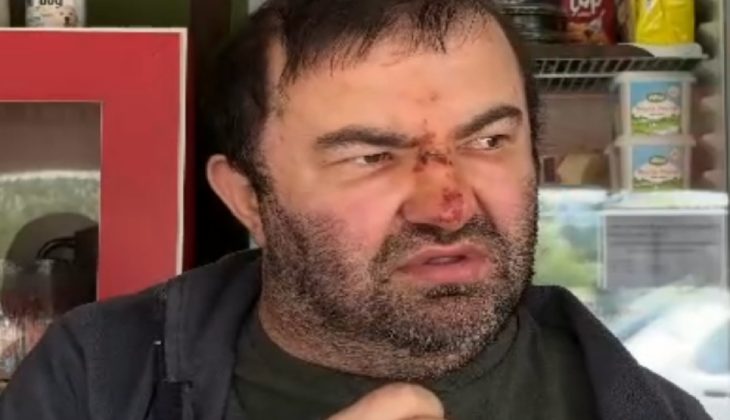 Yüzde 90 Engelli Kişi Akrabası Tarafından Darbedildi