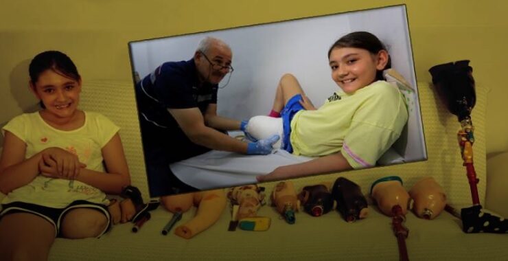 Özge protez bacağına kavuşuyor okula gitmek için gün sayıyor