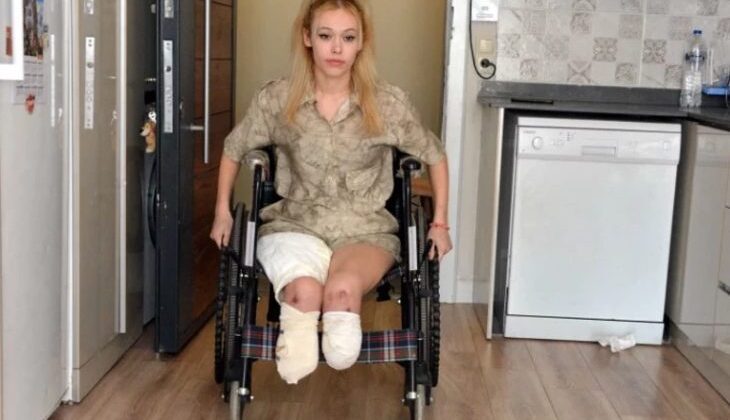 İKİ AYAĞIMI KOPTUĞUNU GÖRÜNCE MAHVOLDUM’