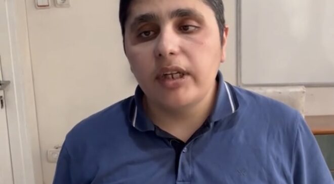 Görme Engelli Cüneyt Tarat’tan Bakan Şimşek’e Çağrı: “ÖTV Muafiyeti Kapsamı Genişletilmeli”